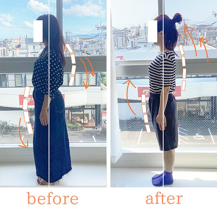 ビフォーアフター