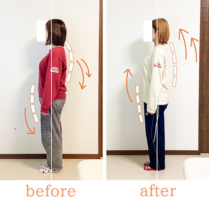 ビフォーアフター