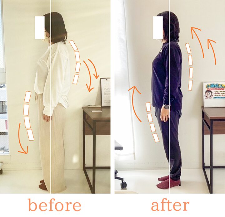 ビフォーアフター