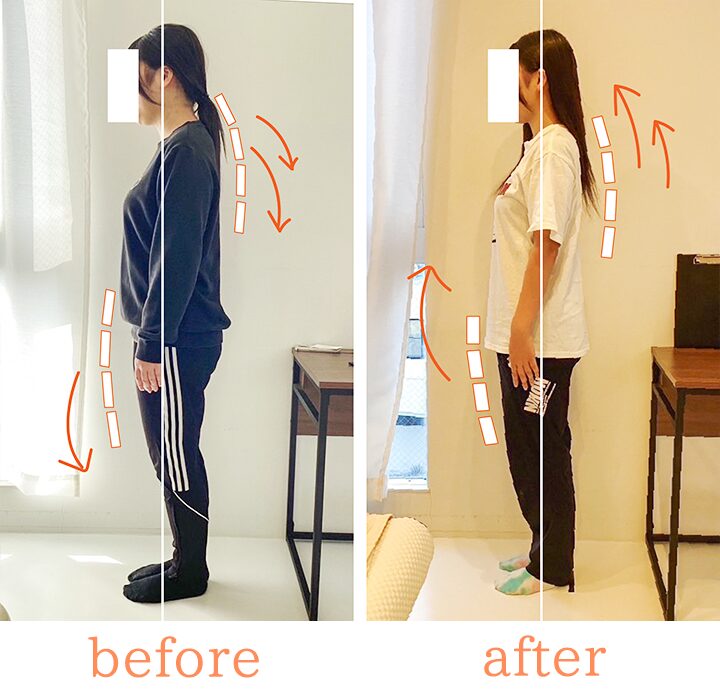 ビフォーアフター