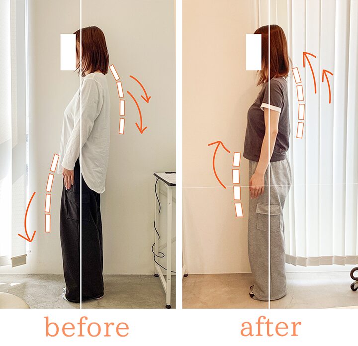 ビフォーアフター