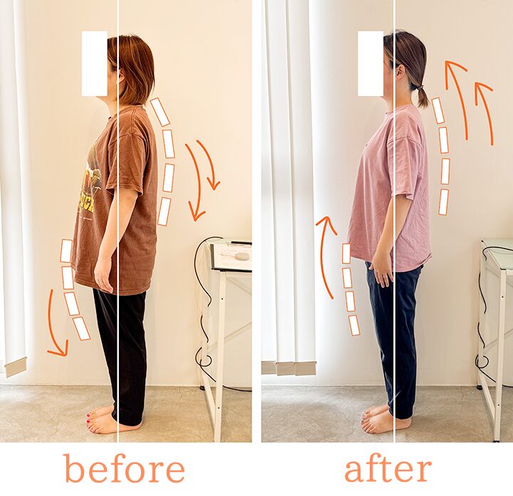 ビフォーアフター