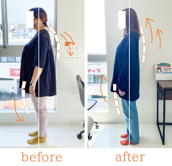 ビフォーアフター