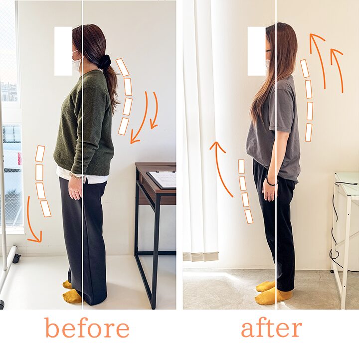 ビフォーアフター