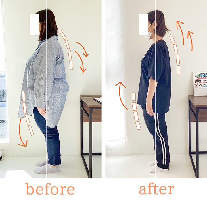 ビフォーアフター