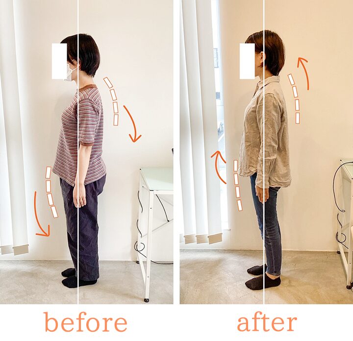 ビフォーアフター