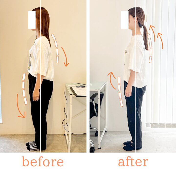 ビフォーアフター