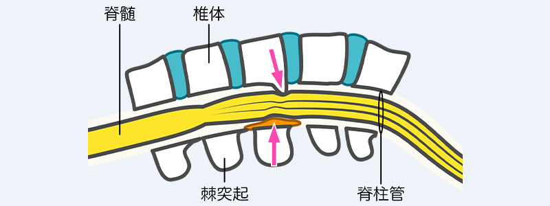 脊柱管のイメージ